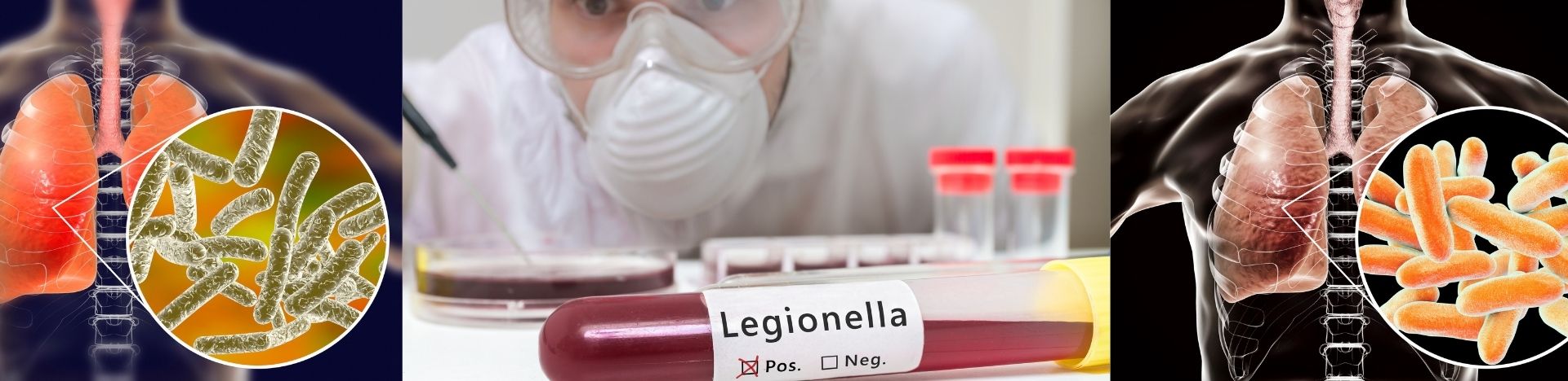 Anti-Legionella Valve
